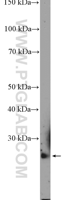 Western Blot (WB) analysis of mouse thymus tissue using C19orf20 Polyclonal antibody (26113-1-AP)