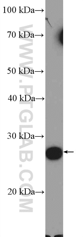 Western Blot (WB) analysis of human plasma using C19orf20 Polyclonal antibody (26113-1-AP)