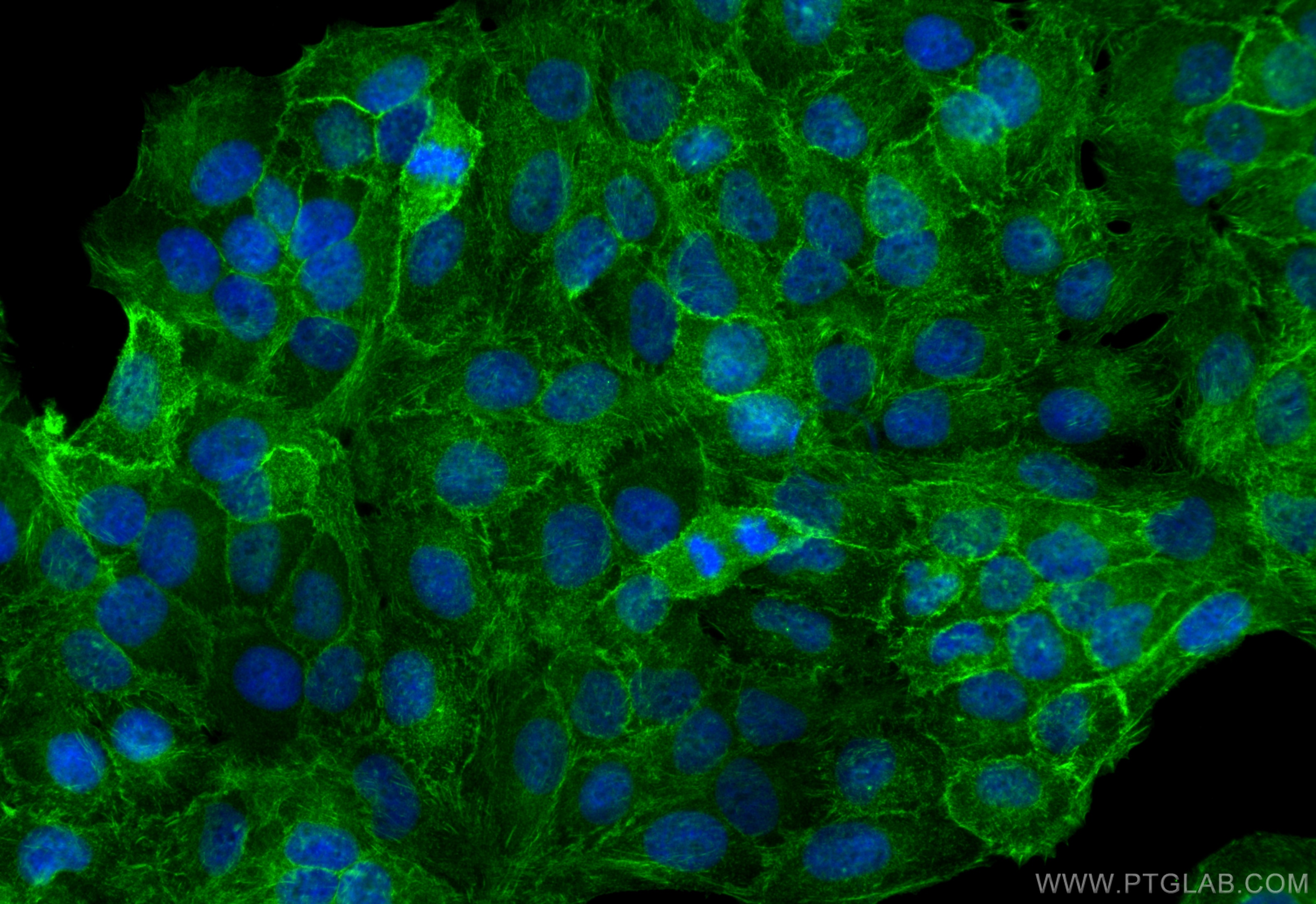 Immunofluorescence (IF) / fluorescent staining of HaCaT cells using C19orf21 Polyclonal antibody (26338-1-AP)
