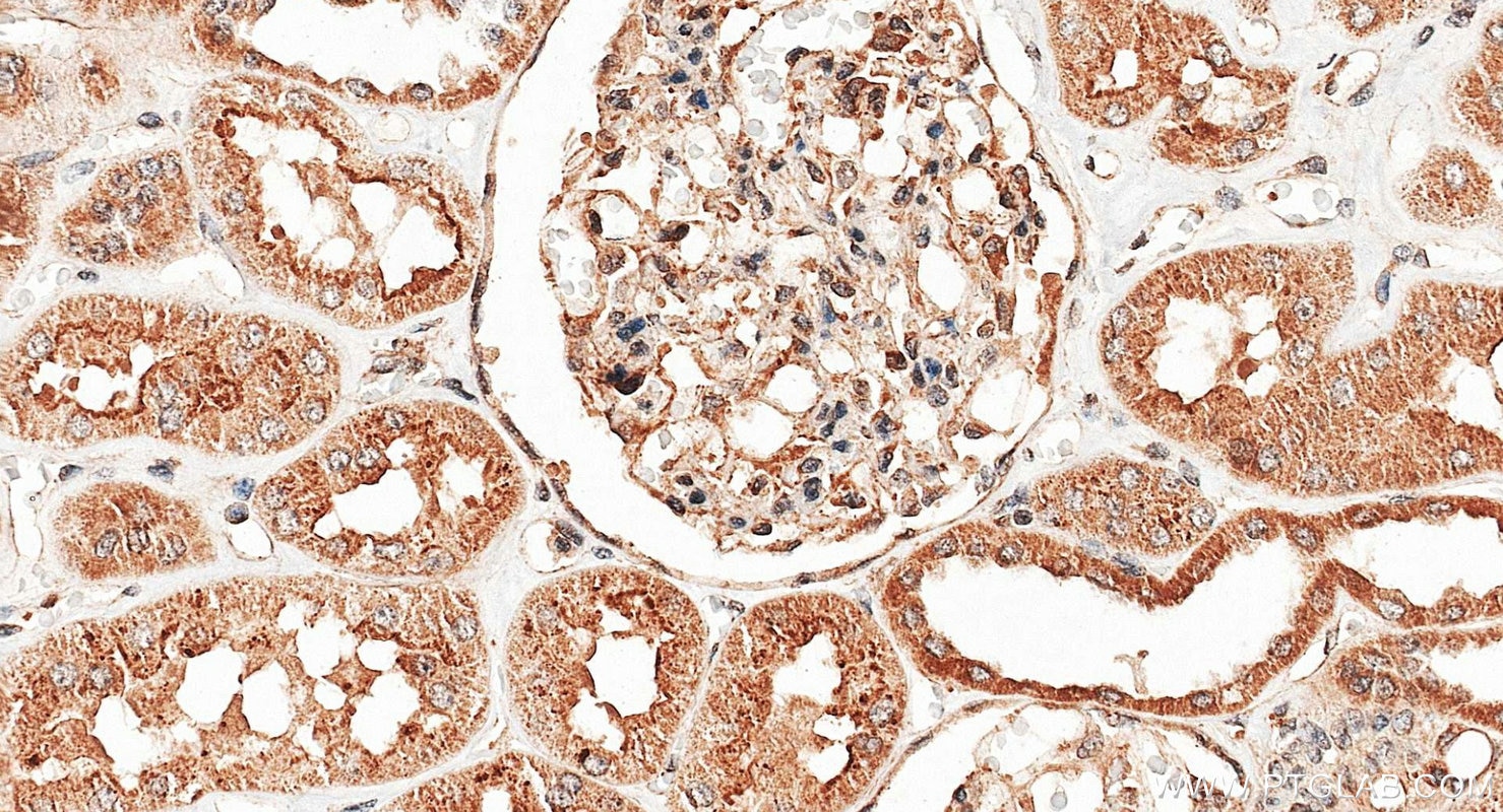 Immunohistochemistry (IHC) staining of human kidney tissue using C19orf21 Polyclonal antibody (26338-1-AP)
