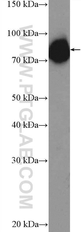 WB analysis of MCF-7 using 26338-1-AP