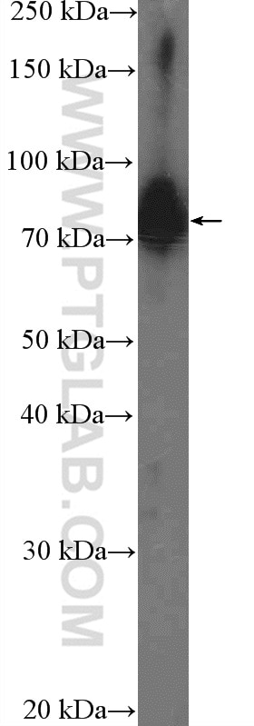 WB analysis of HepG2 using 26338-1-AP