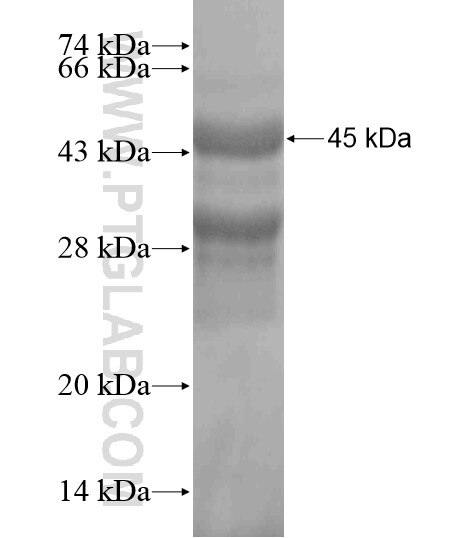 C19orf25 fusion protein Ag20472 SDS-PAGE