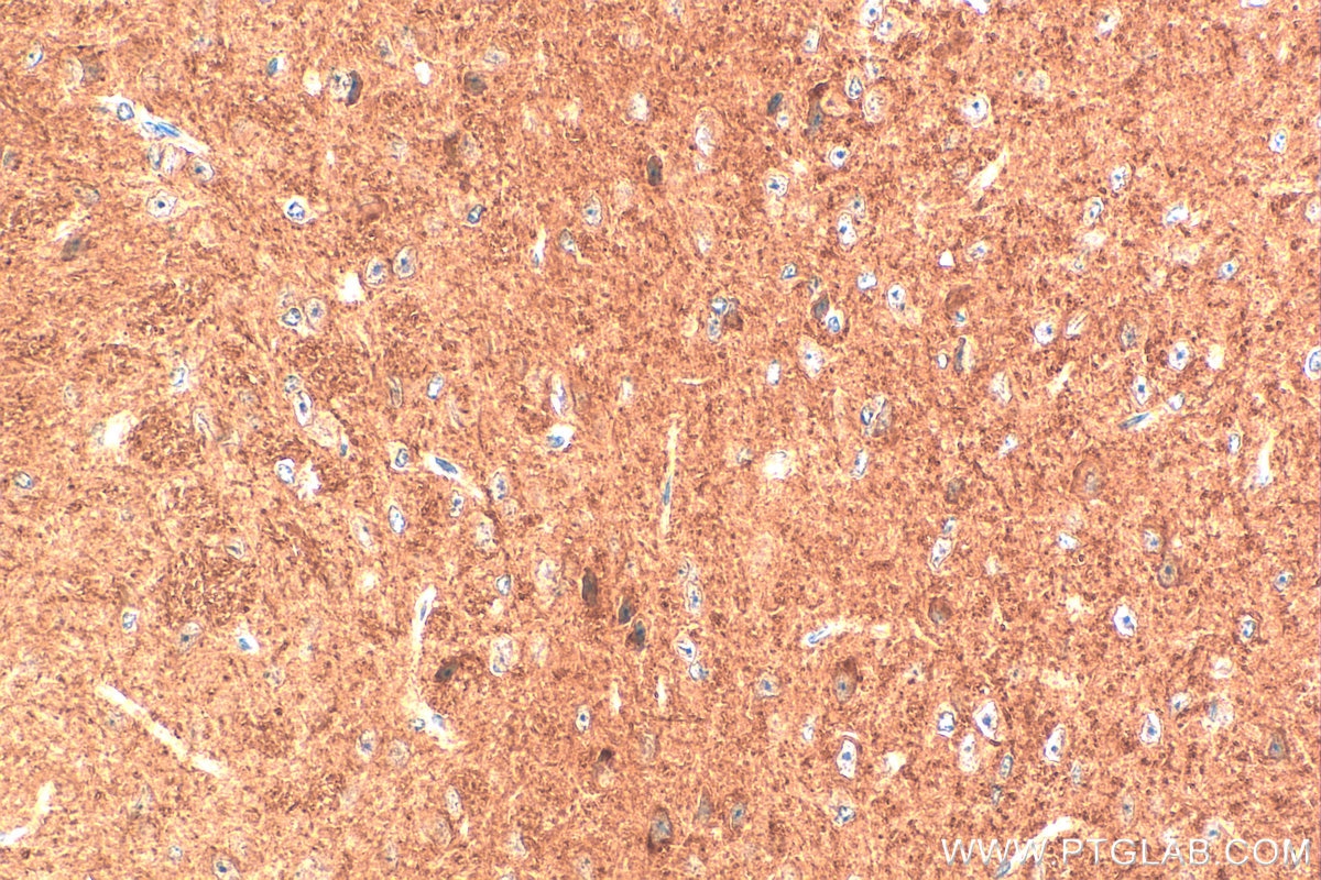 Immunohistochemistry (IHC) staining of mouse brain tissue using C19orf26 Polyclonal antibody (28011-1-AP)