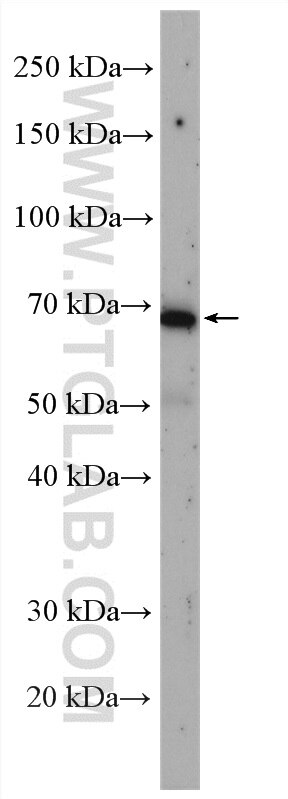 Western Blot (WB) analysis of U2OS cells using C19orf26 Polyclonal antibody (28011-1-AP)