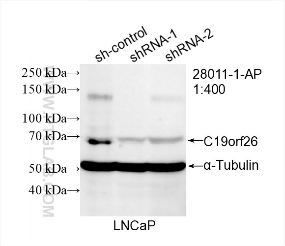 Western Blot (WB) analysis of LNCaP cells using C19orf26 Polyclonal antibody (28011-1-AP)