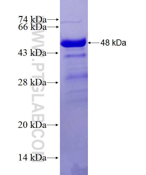 C19orf26 fusion protein Ag27725 SDS-PAGE