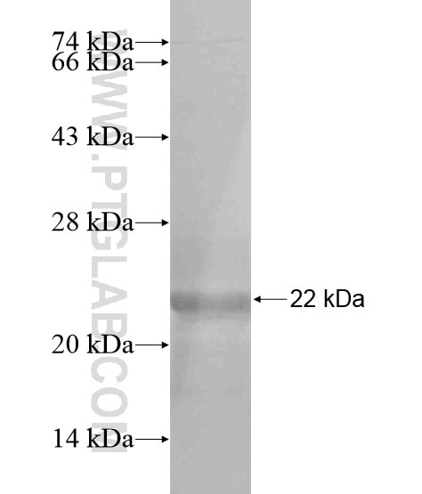 C19orf34 fusion protein Ag19804 SDS-PAGE