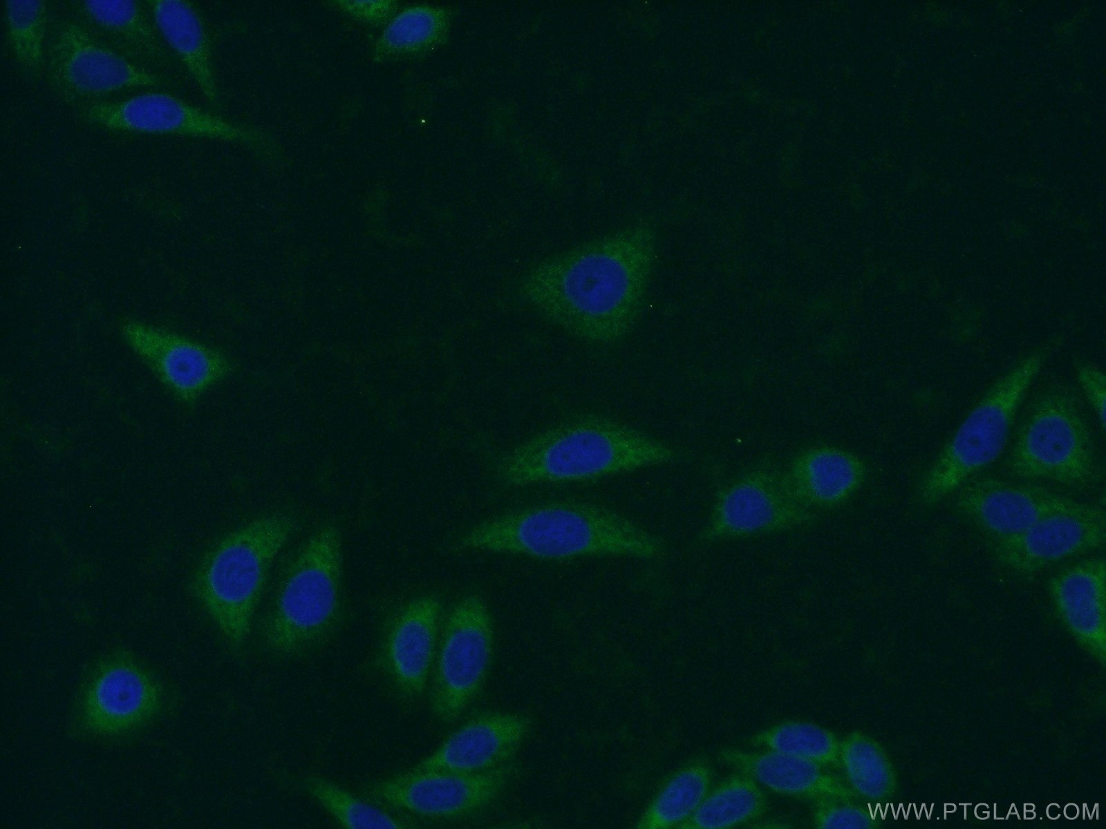 Immunofluorescence (IF) / fluorescent staining of HepG2 cells using C19orf36 Polyclonal antibody (25650-1-AP)