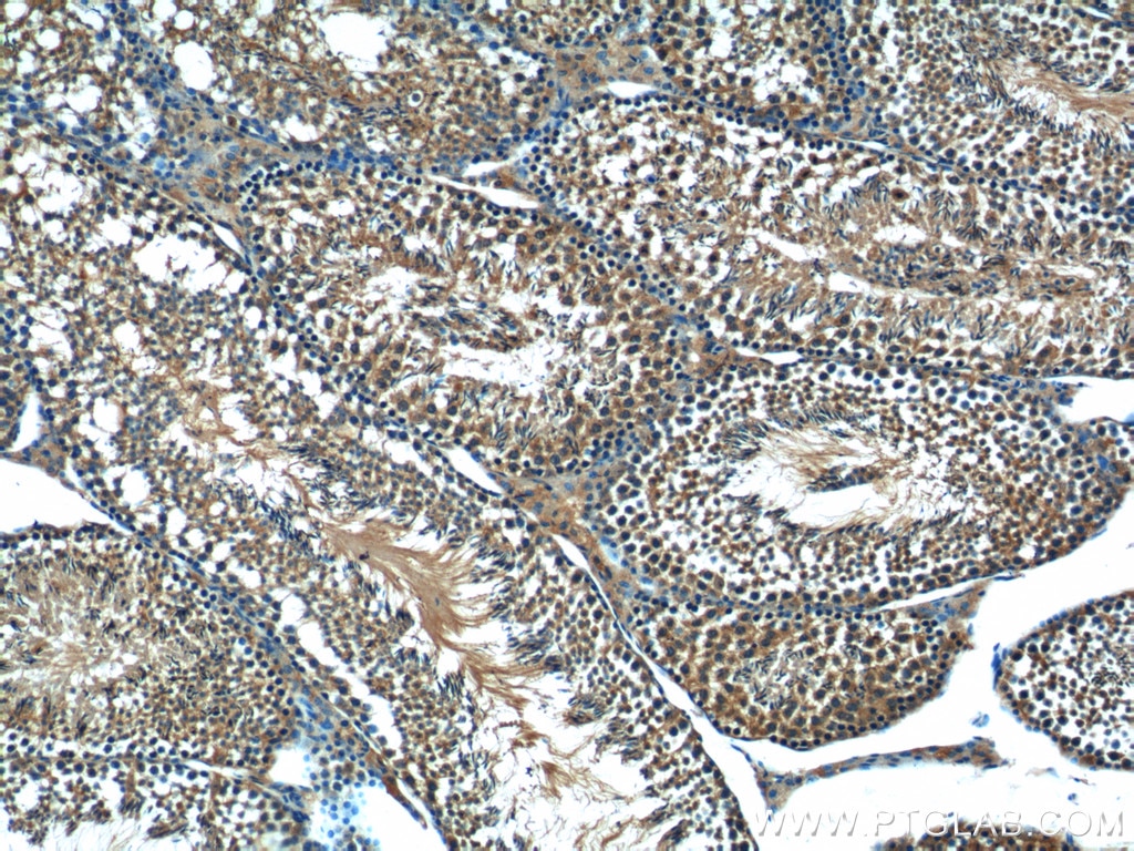 Immunohistochemistry (IHC) staining of mouse testis tissue using C19orf36 Polyclonal antibody (25650-1-AP)