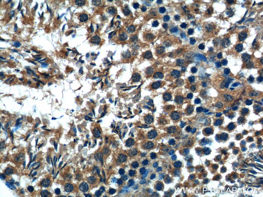 Immunohistochemistry (IHC) staining of mouse testis tissue using C19orf36 Polyclonal antibody (25650-1-AP)