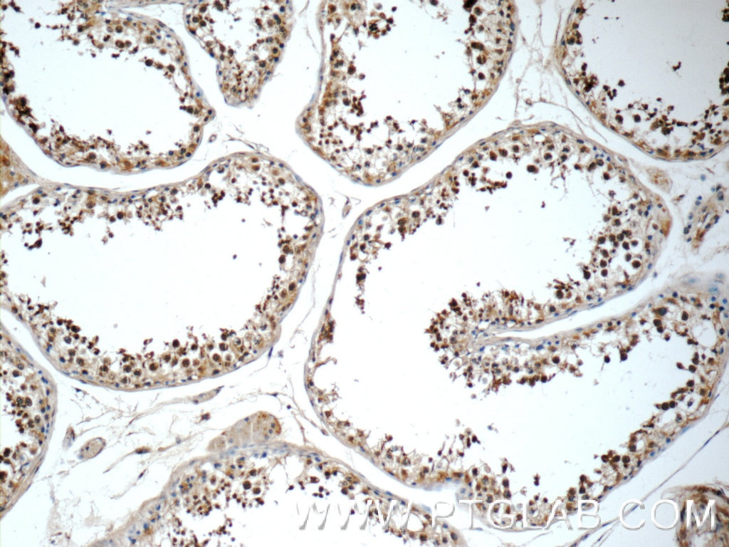 Immunohistochemistry (IHC) staining of human testis tissue using C19orf36 Polyclonal antibody (25650-1-AP)