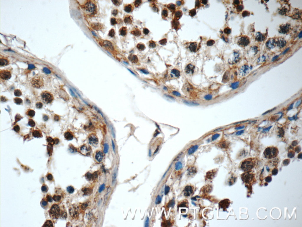 Immunohistochemistry (IHC) staining of human testis tissue using C19orf36 Polyclonal antibody (25650-1-AP)