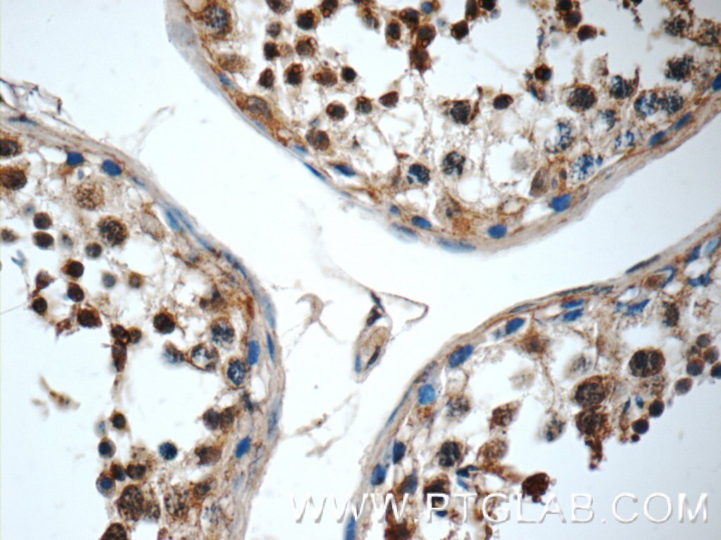 Immunohistochemistry (IHC) staining of human testis tissue using C19orf36 Polyclonal antibody (25650-1-AP)