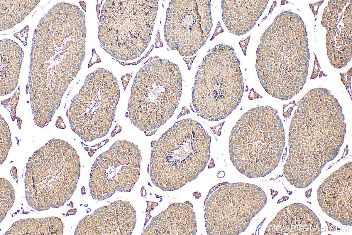 Immunohistochemistry (IHC) staining of mouse testis tissue using C19orf36 Polyclonal antibody (25650-1-AP)
