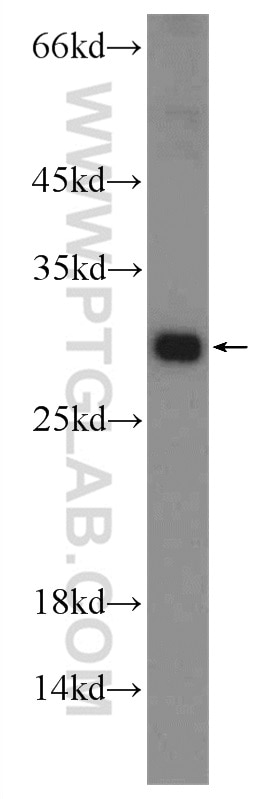 Western Blot (WB) analysis of mouse testis tissue using C19orf36 Polyclonal antibody (25650-1-AP)