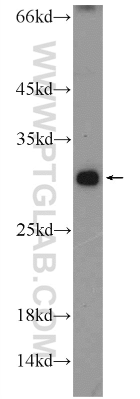 Western Blot (WB) analysis of HepG2 cells using C19orf36 Polyclonal antibody (25650-1-AP)