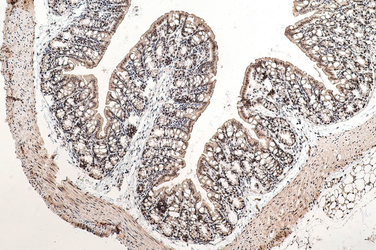 Immunohistochemistry (IHC) staining of mouse colon tissue using C19orf43 Polyclonal antibody (19420-1-AP)