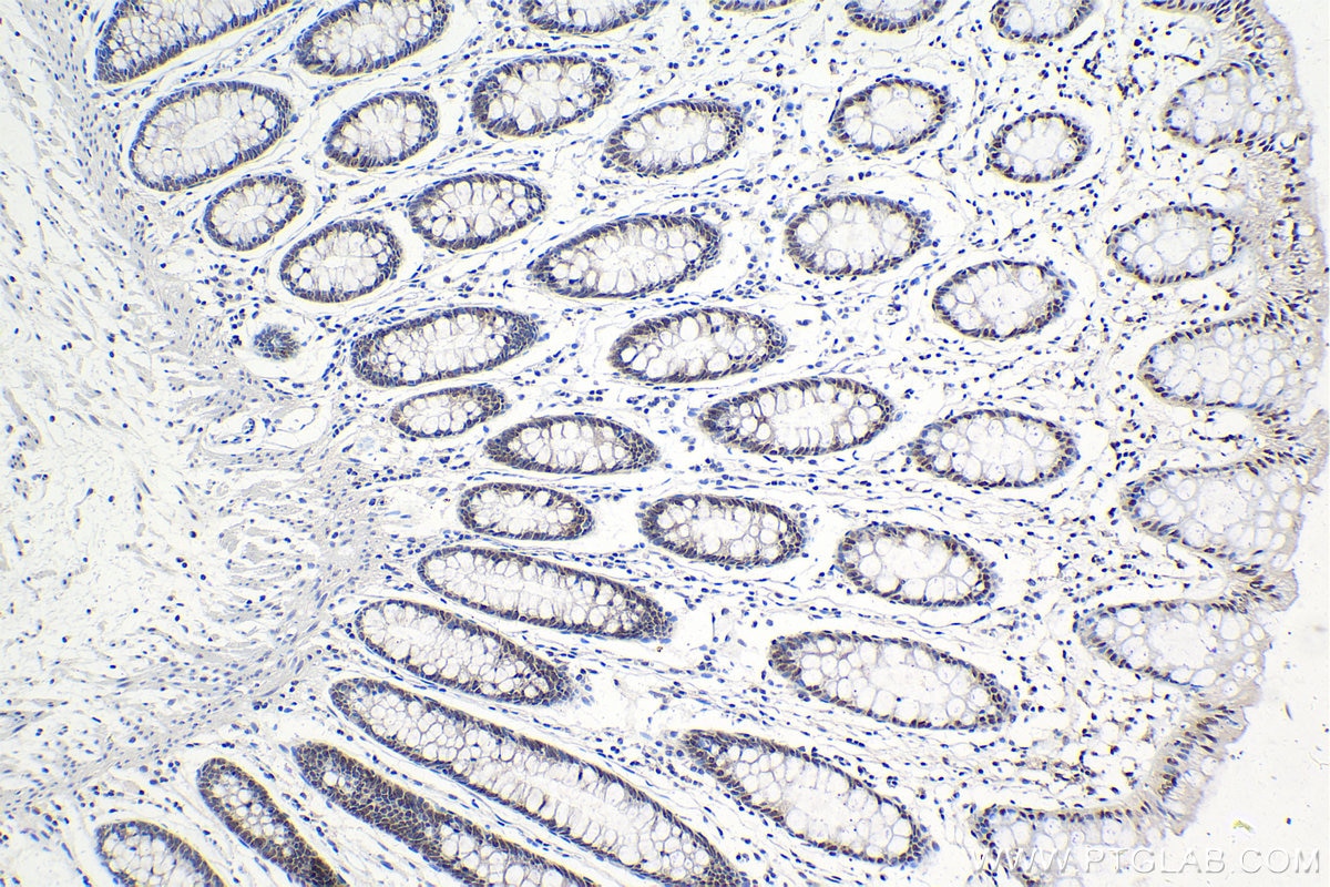 Immunohistochemistry (IHC) staining of human colon tissue using C19orf43 Polyclonal antibody (19420-1-AP)