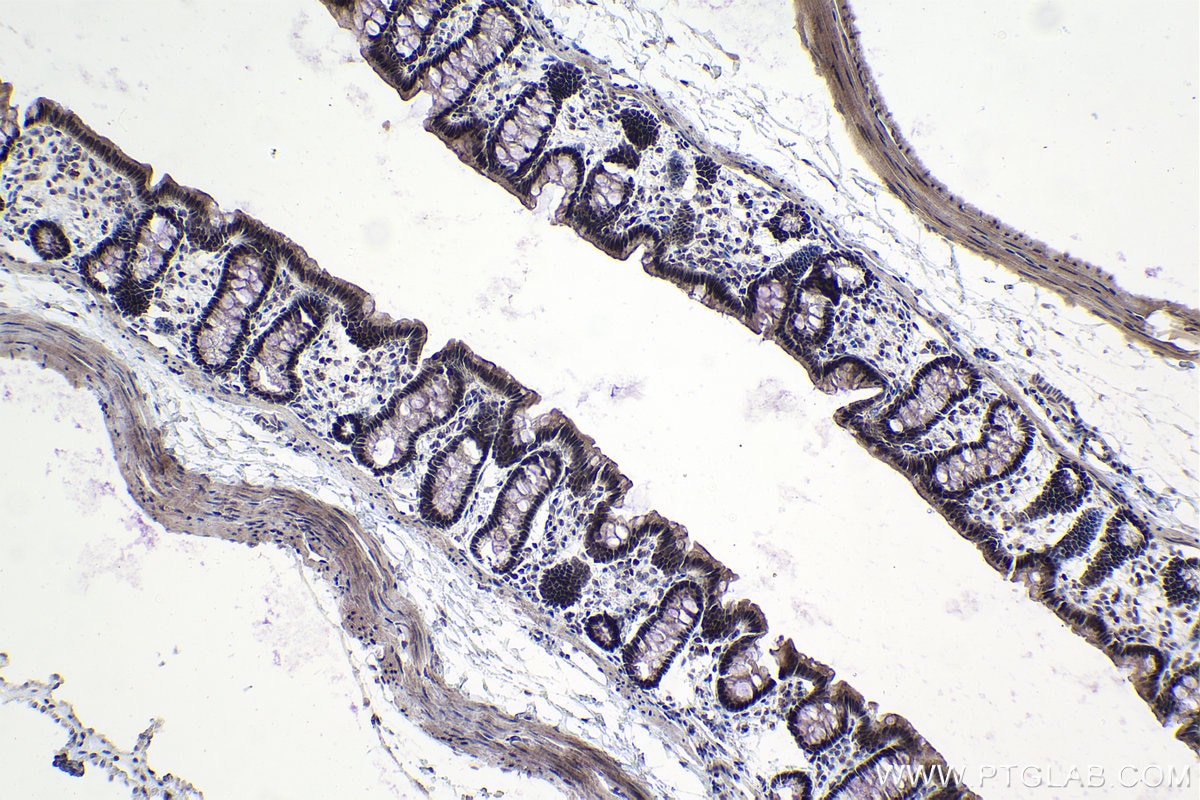 Immunohistochemistry (IHC) staining of rat colon tissue using C19orf43 Polyclonal antibody (19420-1-AP)