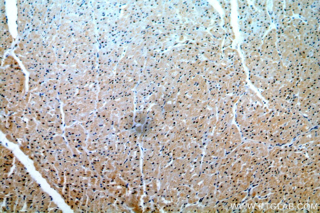 Immunohistochemistry (IHC) staining of human heart tissue using C19orf43 Polyclonal antibody (19420-1-AP)