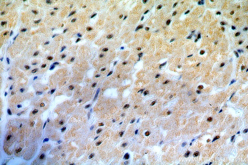 Immunohistochemistry (IHC) staining of human heart tissue using C19orf43 Polyclonal antibody (19420-1-AP)