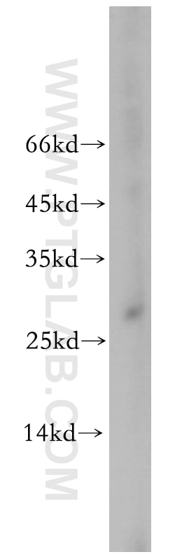 Western Blot (WB) analysis of A431 cells using C19orf43 Polyclonal antibody (19420-1-AP)
