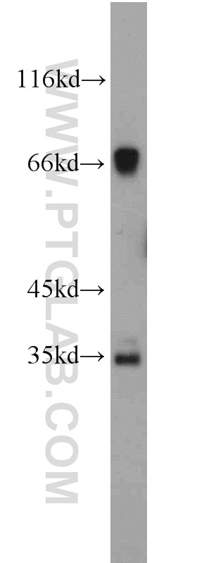 Western Blot (WB) analysis of mouse liver tissue using C19orf44 Polyclonal antibody (21503-1-AP)