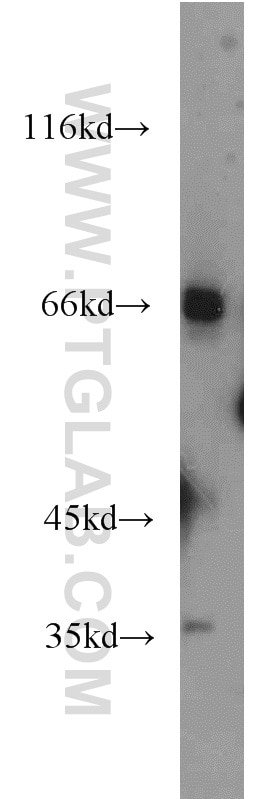 Western Blot (WB) analysis of mouse liver tissue using C19orf44 Polyclonal antibody (21503-1-AP)