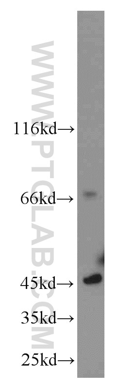 Western Blot (WB) analysis of rat brain tissue using C19orf44 Polyclonal antibody (21503-1-AP)