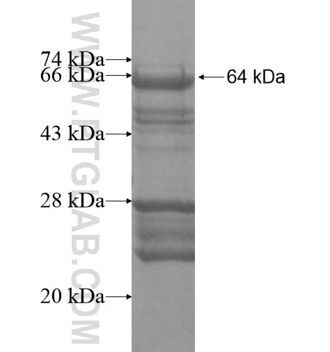 C19orf44 fusion protein Ag15960 SDS-PAGE