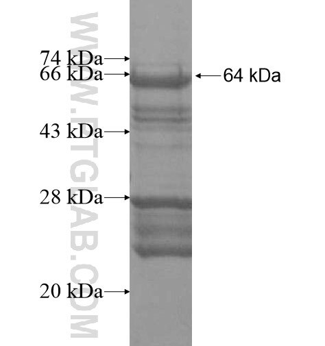 C19orf44 fusion protein Ag15960 SDS-PAGE