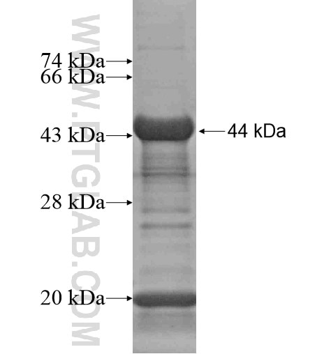 C19orf44 fusion protein Ag15975 SDS-PAGE
