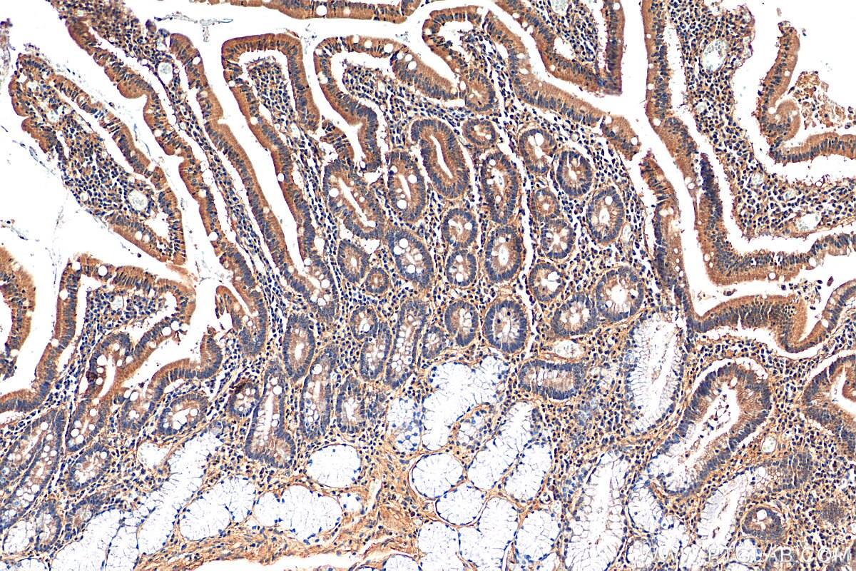 Immunohistochemistry (IHC) staining of human stomach tissue using C19orf45 Polyclonal antibody (21060-1-AP)