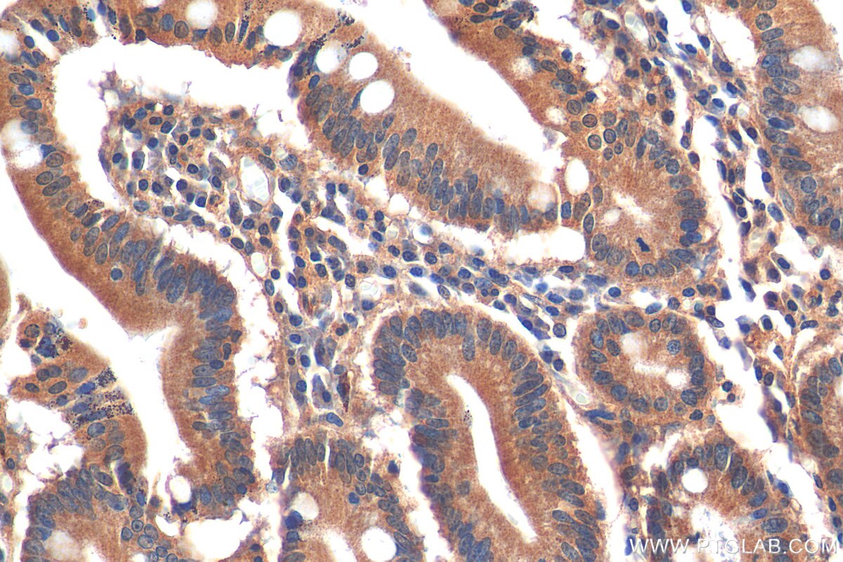 Immunohistochemistry (IHC) staining of human stomach tissue using C19orf45 Polyclonal antibody (21060-1-AP)