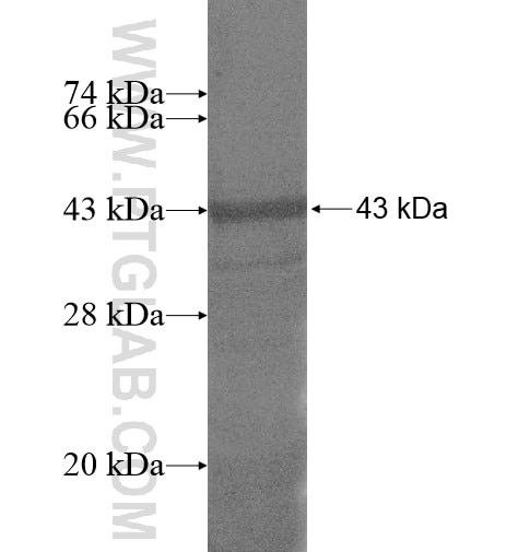C19orf45 fusion protein Ag14887 SDS-PAGE