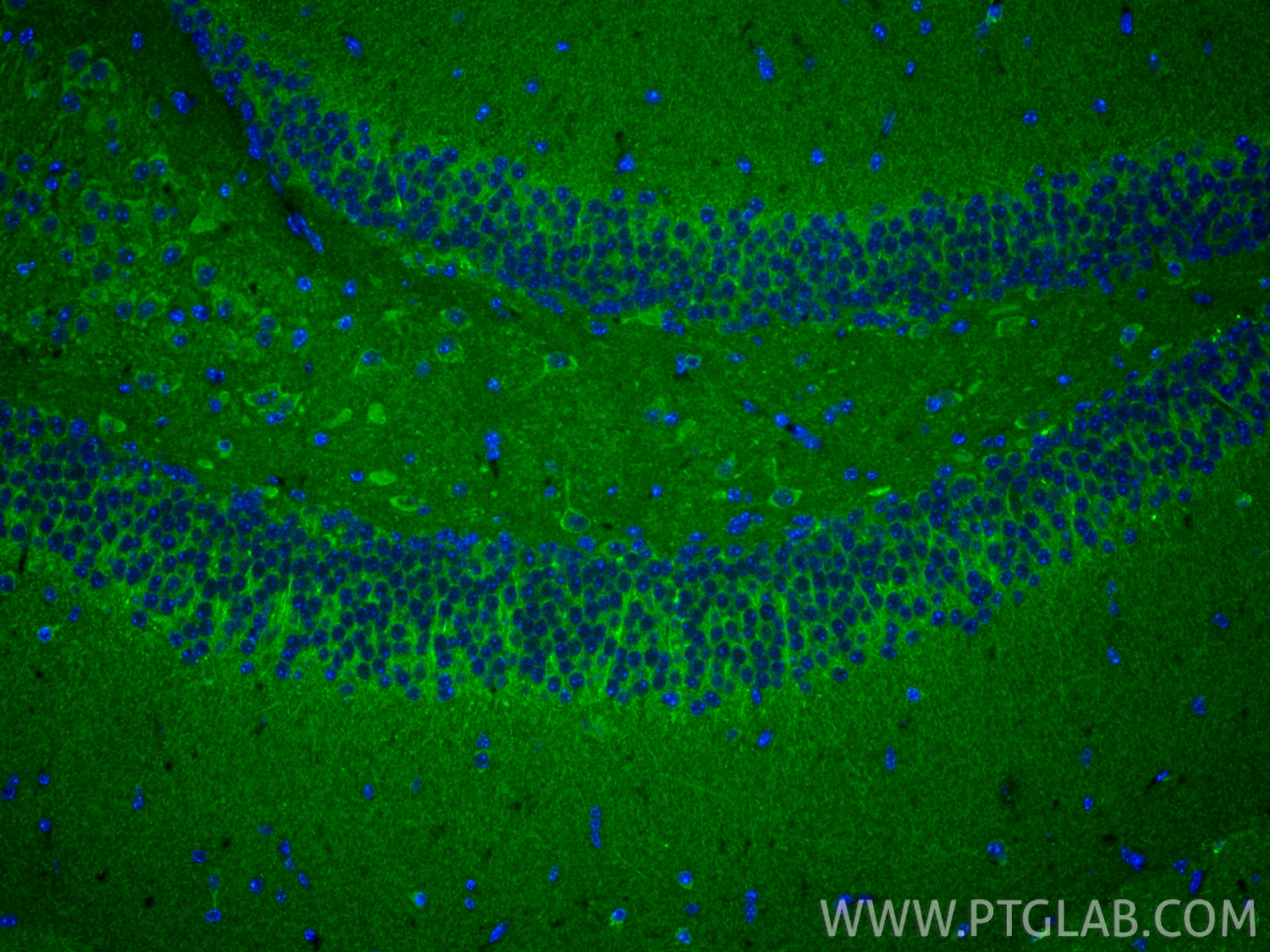 Immunofluorescence (IF) / fluorescent staining of mouse brain tissue using C19orf52 Polyclonal antibody (25652-1-AP)