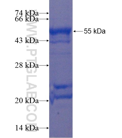 C19orf52 fusion protein Ag22251 SDS-PAGE