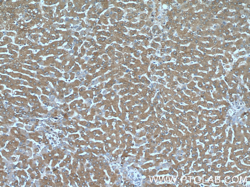 Immunohistochemistry (IHC) staining of human liver tissue using C19orf54 Polyclonal antibody (26299-1-AP)