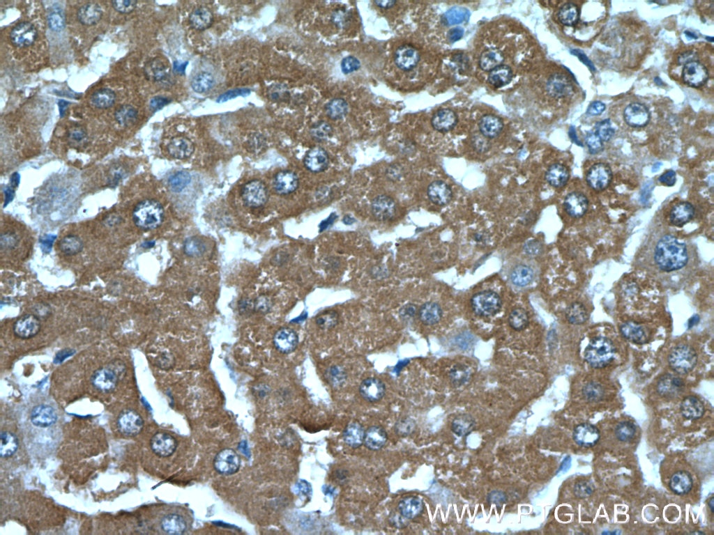 Immunohistochemistry (IHC) staining of human liver tissue using C19orf54 Polyclonal antibody (26299-1-AP)