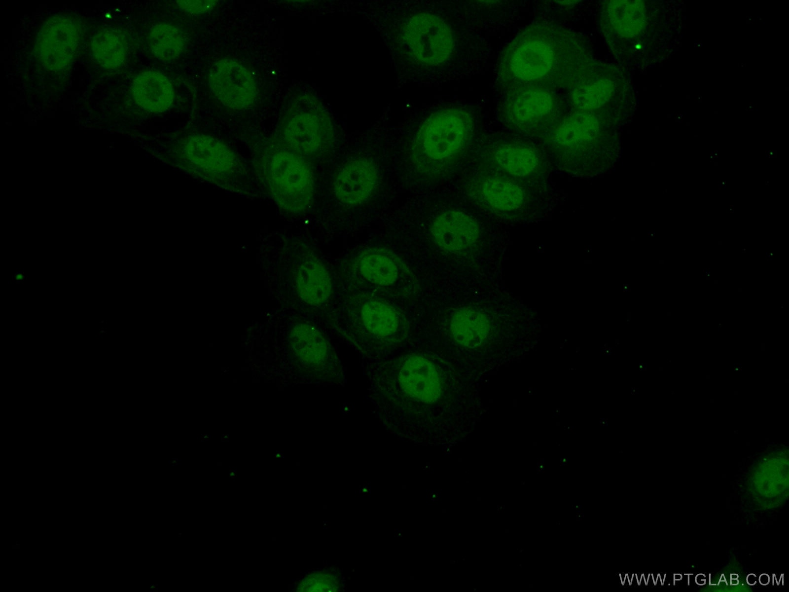 Immunofluorescence (IF) / fluorescent staining of A431 cells using C19orf57 Polyclonal antibody (25050-1-AP)