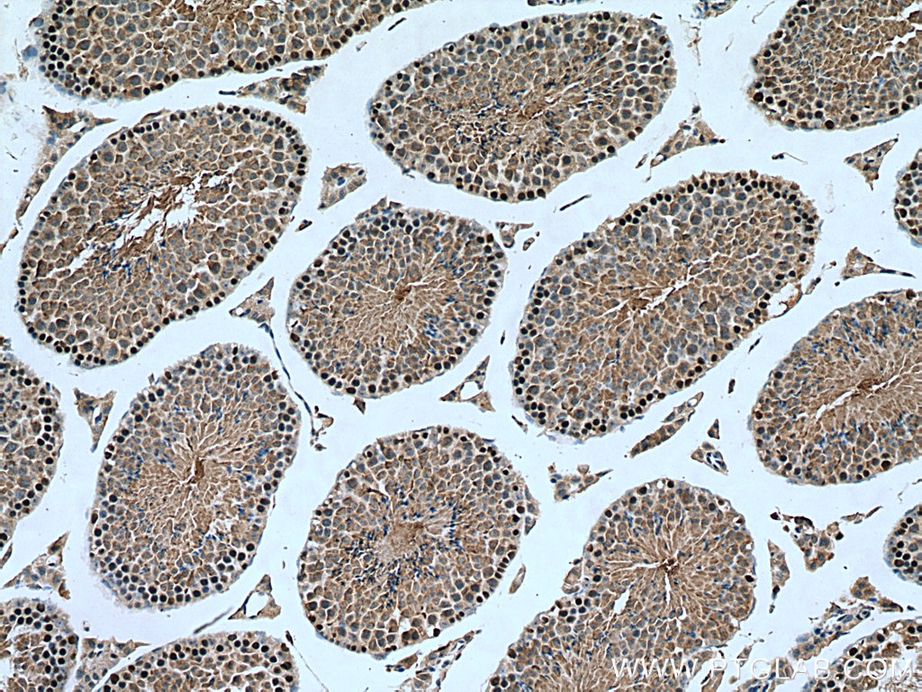 Immunohistochemistry (IHC) staining of mouse testis tissue using C19orf57 Polyclonal antibody (25050-1-AP)
