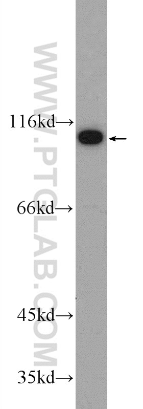 Western Blot (WB) analysis of A2780 cells using C19orf57 Polyclonal antibody (25050-1-AP)