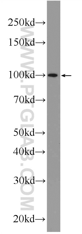 Western Blot (WB) analysis of A431 cells using C19orf57 Polyclonal antibody (25050-1-AP)