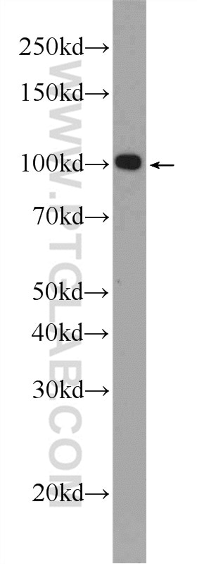 Western Blot (WB) analysis of K-562 cells using C19orf57 Polyclonal antibody (25050-1-AP)