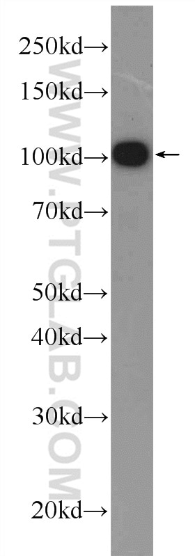 Western Blot (WB) analysis of PC-3 cells using C19orf57 Polyclonal antibody (25050-1-AP)