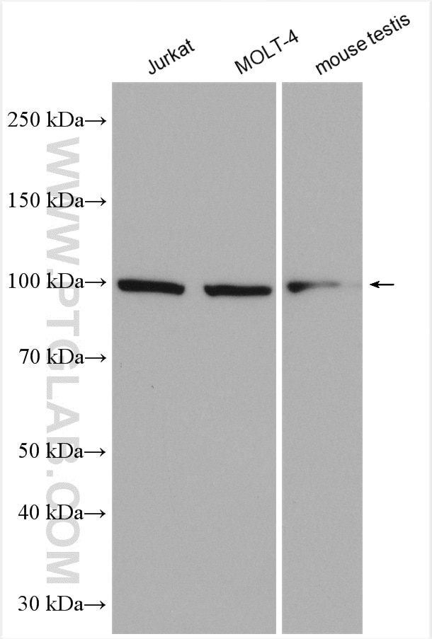 Western Blot (WB) analysis of various lysates using C19orf57 Polyclonal antibody (25050-1-AP)
