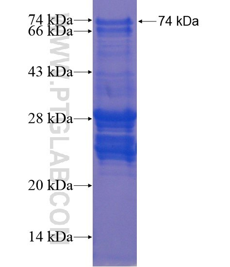 C19orf57 fusion protein Ag21745 SDS-PAGE