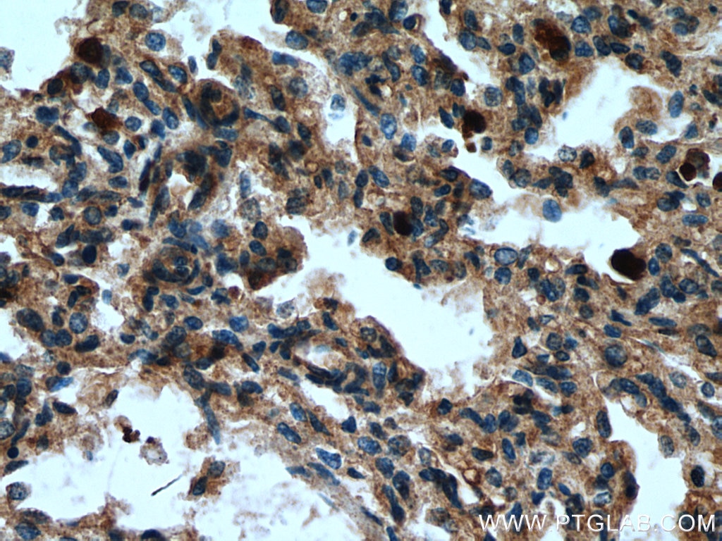 Immunohistochemistry (IHC) staining of human lung tissue using MCEMP1 Polyclonal antibody (25700-1-AP)