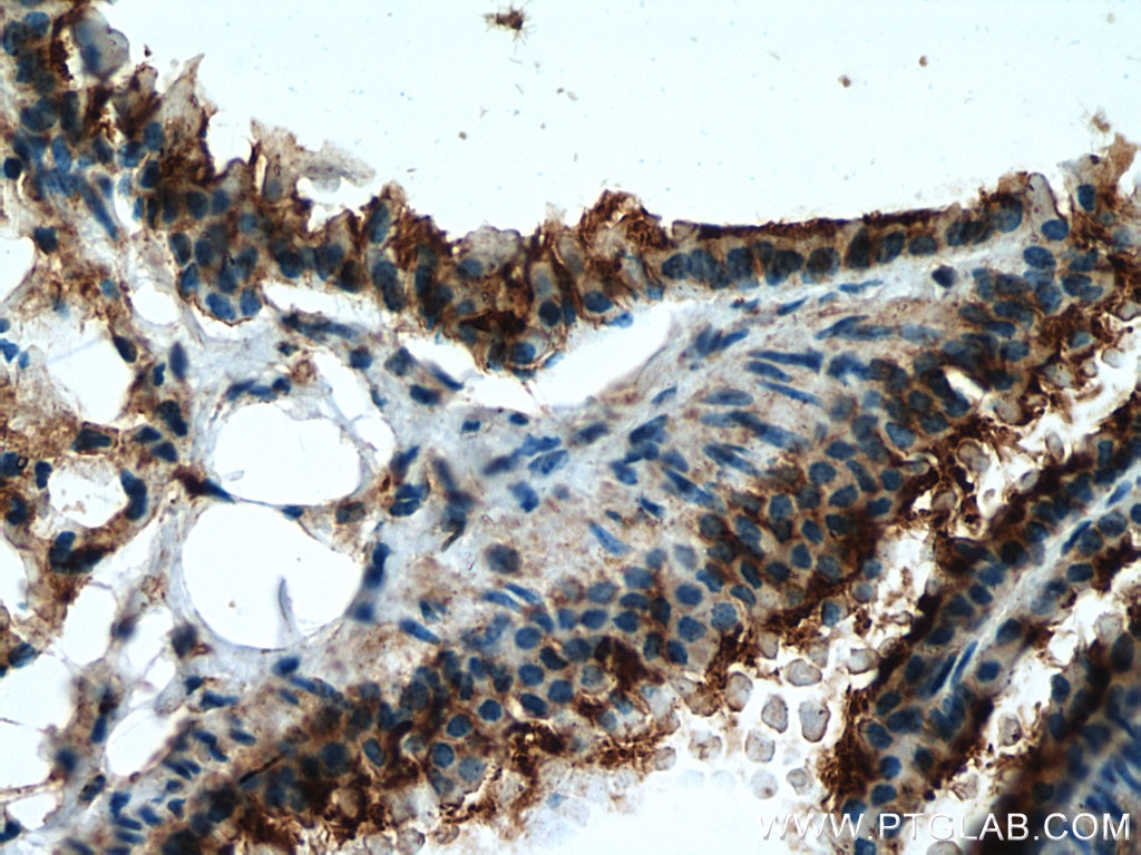 Immunohistochemistry (IHC) staining of mouse lung tissue using MCEMP1 Polyclonal antibody (25700-1-AP)